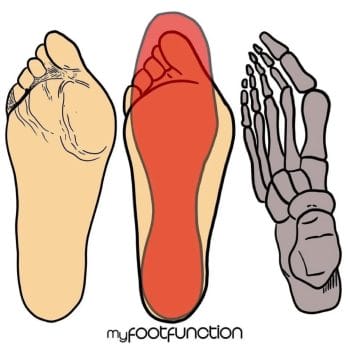 Images of how a foot shape changes because of shoes